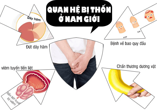 quan hệ bị thốn