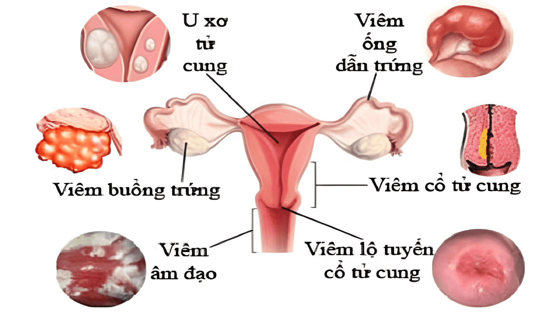 Tại sao khi quan hệ bị thốn