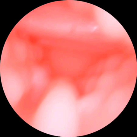 Manmiao Honey Peach nguỵ trang quả đào (1)